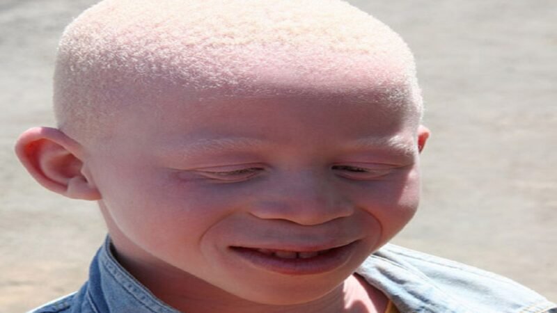 ¿Son dioses los albinos?