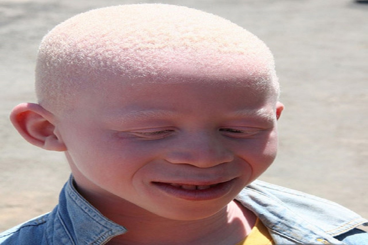 ¿Son dioses los albinos?